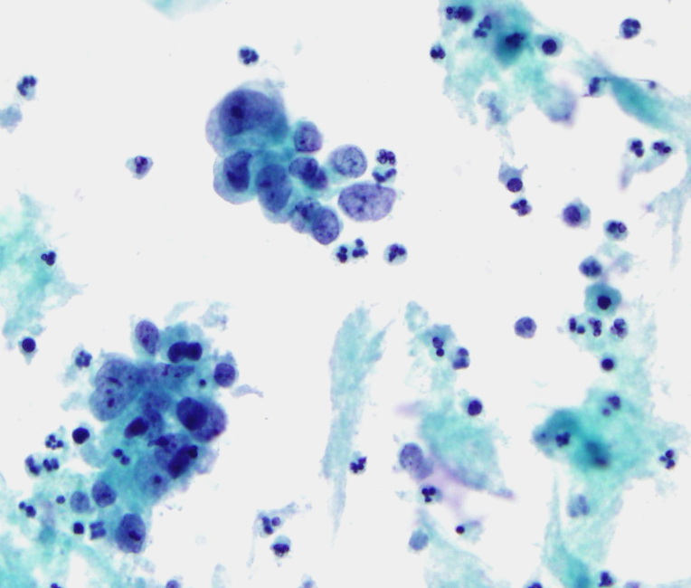 Pap Stain